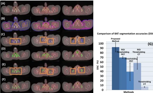 Figure 4.2: For three different anatomical levels (columns), row (A) shows reference standards (white); row (B) demonstrates the results from CT thresholding where pink (inner) and blue (outer) contours show brown fat delineation (blue contour shows fat re