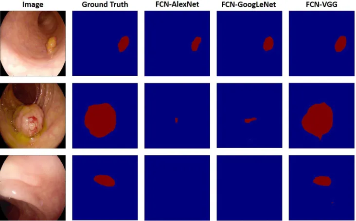 Figure 3: Example of three segmentation produced by three FCN networks.