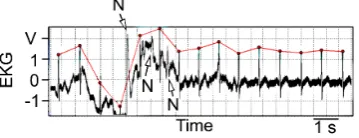 Fig. 3. The same set of recordings as shown in Fig. 2 but  shown in different time scales