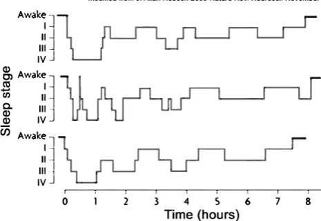 Fig. 4. Representative patterns of sleep. Three different  subjects. We made this figure by modification of the original report to show typical sleep patterns