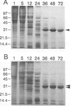 FIG. 5.cated5,ofthatAcNPV 12, polyhedrin. SDS-PAGE of pulse-labeled proteins from BmN cells were infected with eh2-AcNPV (A) and BmNPV and eh2- (B)