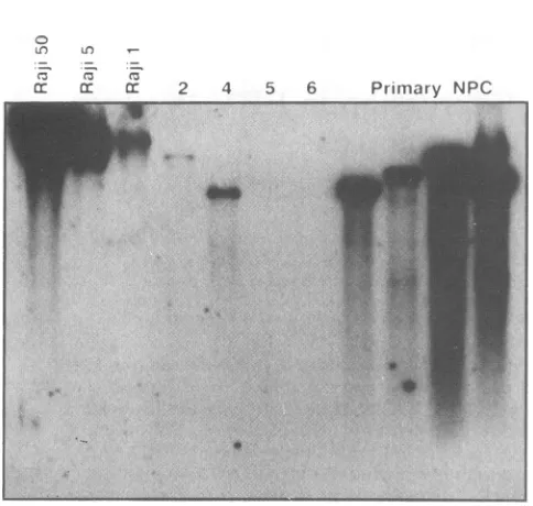 TABLE 1. PCR analysis of EBV gene expression in PTLs