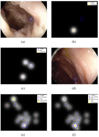 Fig. 9. Examples of the benefits of using a saliency-map-based approach.