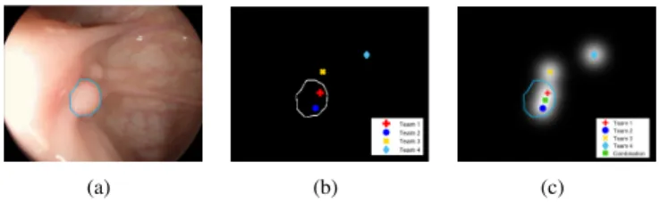 Fig. 2. Synthetical examples of different ways to perform a combination of methods: (a) original image; (b) result of combination by union, and (c) result of combination by saliency map creation