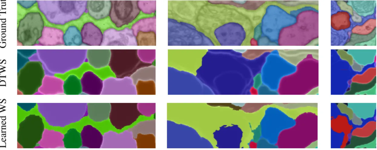 Figure 2.5: Detailed success and failure cases of our method. Success case: long thin neurites (left), weak boundaries (middle)