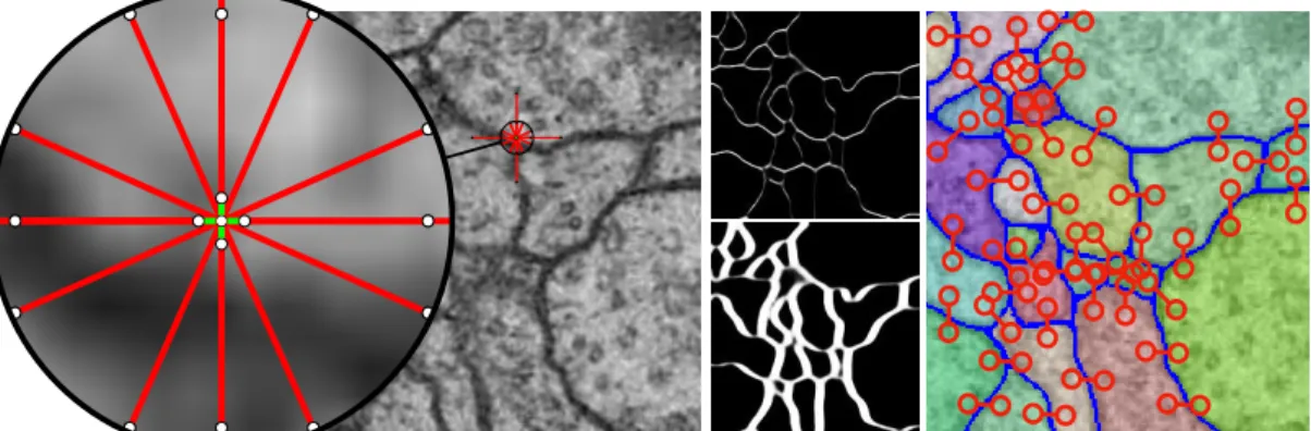 Figure 3.1: Left: Overlay of raw data from the ISBI 2012 EM segmentation challenge and the edges for which attractive (green) or repulsive (red) interactions are estimated for each pixel using a CNN