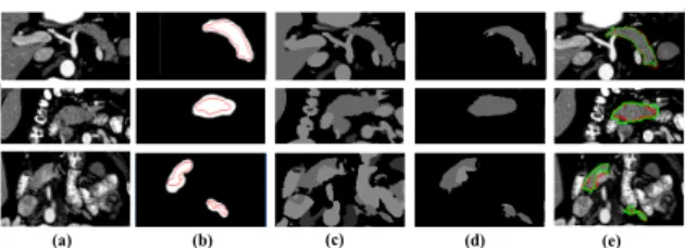 Fig. 3: Visualising proposed approach.
