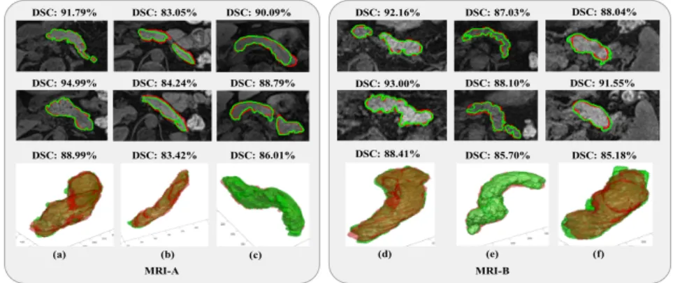 Fig. 4: Segmentation results in six different MRI scans (volumes). Every column corre- corre-sponds to a single MRI volume