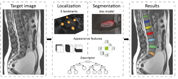 Figure 2: A schematic illustration of the method developed by Korez et al. (Korez et al., 2015a).