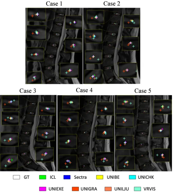 Figure 4: Visual comparison of localization results for the ground truth (GT) as well as for the 8 submitted methods on Test1 data, where localization results of 7 IVDs on the mid-sagittal slice are shown