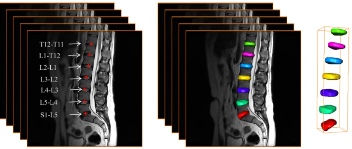 Figure 1: The 7 IVDs to be localized and segmented from each image.