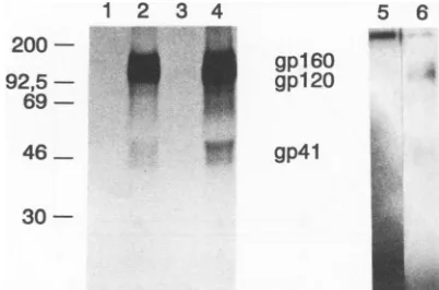 FIG. 3.products.preimmuneplexesbandsAMAfectedafter(lanesPEGCAcorrespondanti-gp120respectively.(inare Immunoprecipitation of radiolabeled HIV-1 env gene COS 7 cells transfected with pNL4-3 (WT) or pNLA3- (AMA) were labeled with [3H]glucosamine from 12 to 48