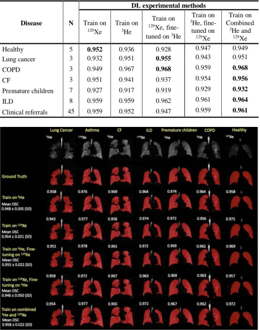Table 5. Comparison of segmentation performance of DL methods stratified by disease for 74  testing scans