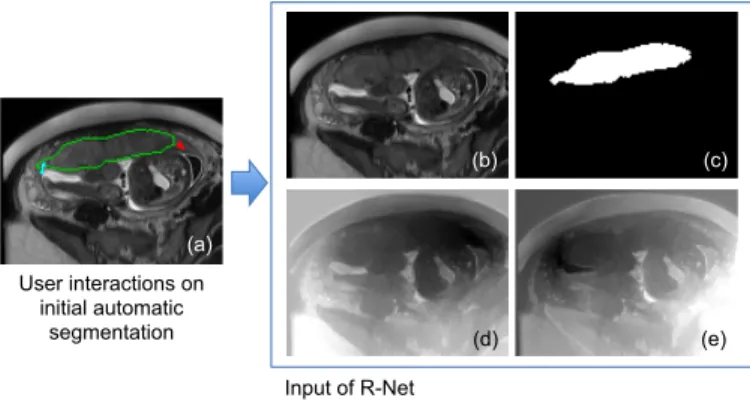 Fig. 2. Input of R-Net in Stage 2. (a) The user provides clicks/scribbles to correct foreground(red) and background(cyan) on the initial automatic segmentation