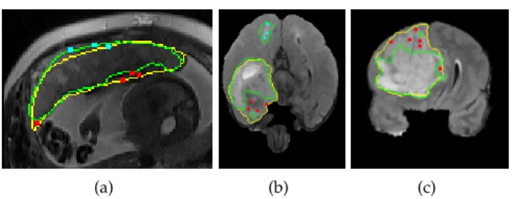 Fig. 5. Simulated user interactions on training images for placenta (a) and brain tumor (b, c)