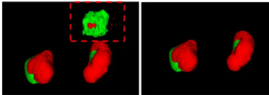 Fig. 2. The effect of our post processing method. The left image is before post pro- pro-cessed, and the volume in dotted box are some voxels obviously wrong