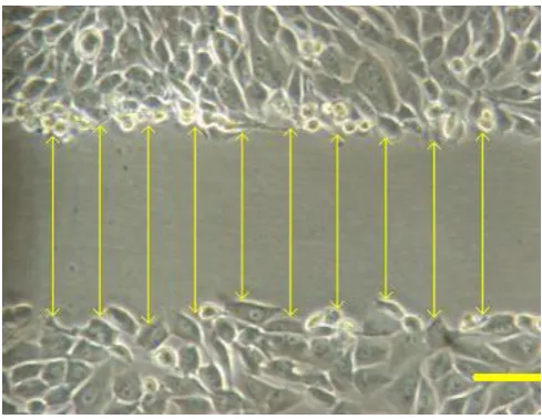 Figure 1. Measurement of wound closure width on cultured MG63 bone cells in the presence of different HCl concentrations and control, using ‘Image J’ software