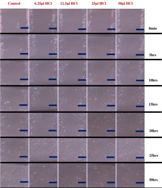 Figure 2. Images of the wound healing process for the bone cell monolayers with four different HCl concentrations and control for the period of 30hrs (Scale bar=100m)