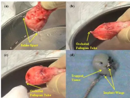 FIGURE 8. Bench-top Pre-Deployed Device introduced into 5F hysteroscope 