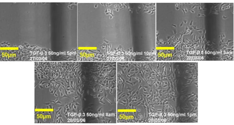 Figure 2. Photomicrographs showing wound closure in the sanicle control at time points 0 houurs, 5 hours, 10 hours 15 hours and 20