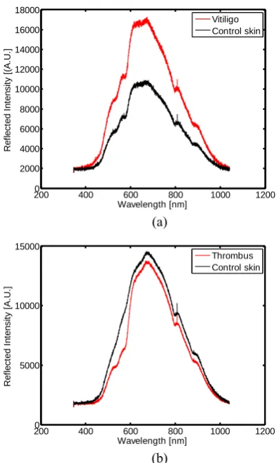 Fig.1. Schematic diagram of diffuse reflectance  spectroscopic system 