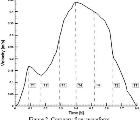 Figure 2. Coronary flow waveform. 