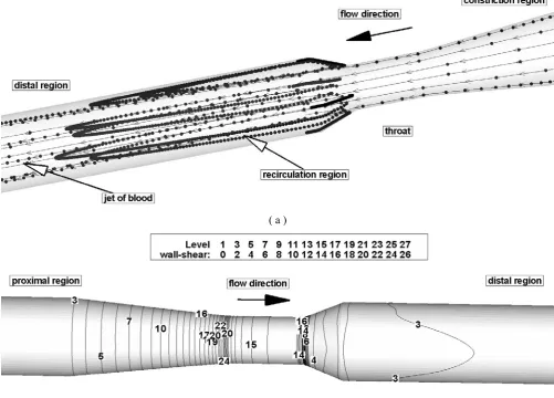 Figure 5. Particle motion (a) and contour plot of WSS magnitude (b) in the constricted region at the time T6=0.64 s
