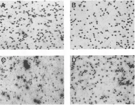 FIG. 3.LCMVaa13 i.v. 1 In situ hybridization of splenic lymphoid cells (A and B) and peripheral blood mononuclear cells (C and D), using [35S]cDNA to NP (see Materials and Methods)