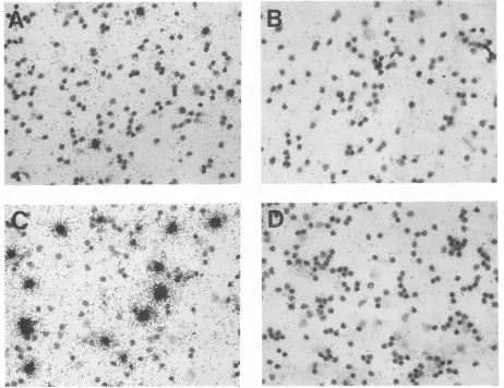 FIG.c~~rviralLCMV(B 4. In situ hybridization of splenic lymphoid cells (A and B) and peripheral blood mononuclear cells (C and D), using [35S]cDNA to NP