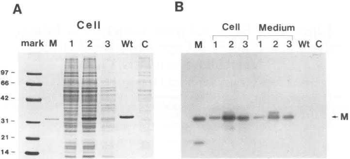 FIG. 1.byVSVbaculoviruscell.by[B]).inepitope1, 2, the Electropherograms of daily synthesis of VSV M protein expressed in SF9 cells by recombinant baculovirus vAcVSV-M, detected Coomassie blue staining of cell lysates (A), Western blot analysis of cell lysa