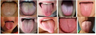 Fig.3 Different textures of tongue. 