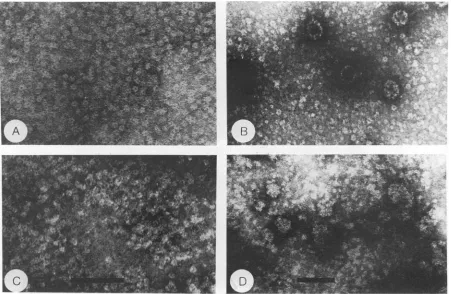 FIG. 4.conditions.conditionsfromC is Electron microscopic analysis of purified recombinant wild-type and mutated polyomavirus VP1 protein under different buffer (A) VP1 expressed from pALVPltac in buffer containing EDTA and P-mercaptoethanol but lacking ca