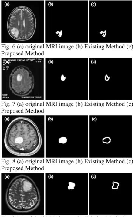 Fig. 9 (a) original MRI image (b) Existing Method (c)  Proposed Method 