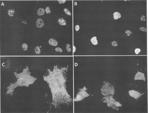 FIG. 2.posttransfection8Ag(1-81); Immunofluorescence analysis of the localization of wild-type and mutant delta antigens