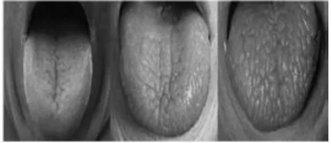 Figure 2. Second, the tongue is the only internal organ that can quite normally and easily be exposed for inspection