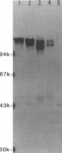 FIG. 3.gB2-9,DNAin1, k which Photograph of an ethidium bromide-stained agarose gel each PCR DNA fragment obtained with primers gBl and was digested with SpeI and electrophoretically separated
