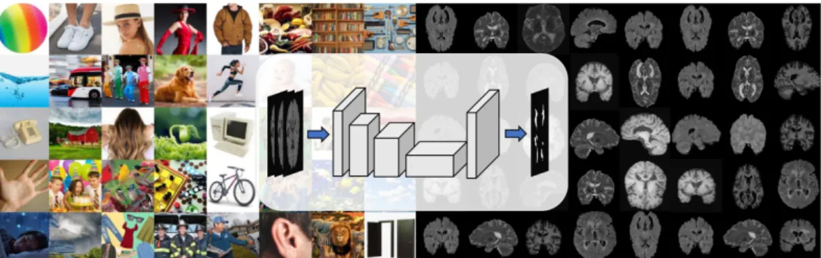Figure 1.5: The learned parameters of a CNN trained to classify natural images of a large dataset (left side) will generalize to segment MS lesion in brain MRI images (right side).