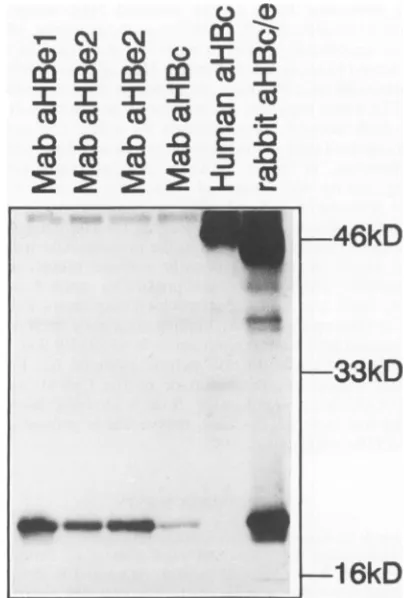 FIG.Recombinantblottingpolyclonalmutatednosticdiagnostic 5. Analysis of the expression efficiency of the WT and HBe proteins used for antigenicity testing with two diag- test kits