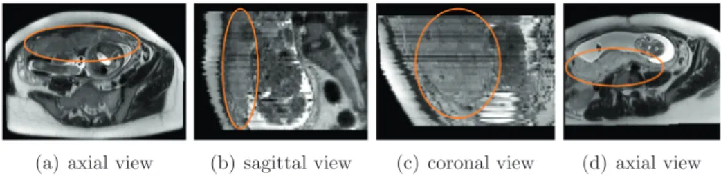 Fig. 1. Examples of fetal MRI. (a), (b) and (c) are from one patient while (d) is from another