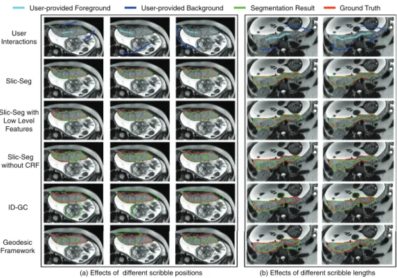 Fig. 5. Segmentation of the placenta by different methods in the start slice. (a) shows the effects of different scribble positions