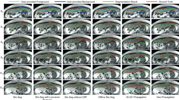 Fig. 6. Propagation in a single volume segmentation of different methods with the same start slice and scribbles