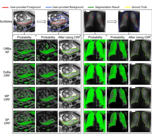 Fig. 2. Visual comparison of DyBa ORF and counterparts in segmentation of (a) pla- pla-centa from fetal MRI and (b) adult lungs from radiographs