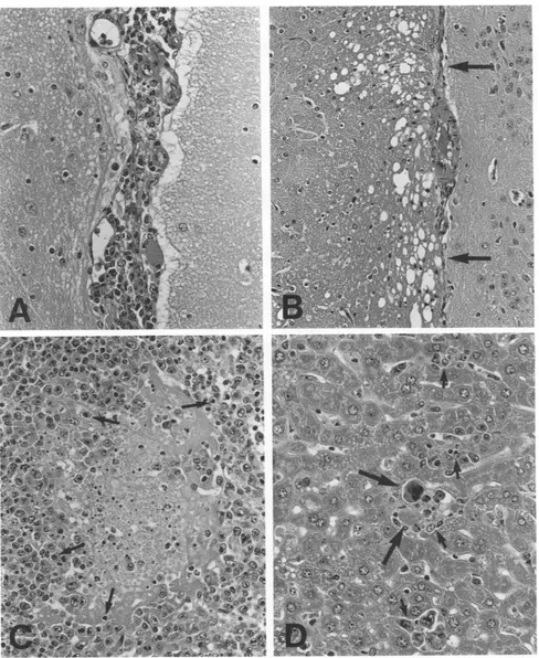FIG. 2.ArmstrongArmstrong(A)afternecrosesx360. Histopathological changes in j32m-lacking mice after infection with LCM virus