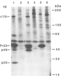 FIG. 6.AntigensmunizedmassmonospecificradiolabeledPr53,acrylamide(lanesandimmunoprecipitated, RIPA of BIV-infected cell lysates with polyvalent and antisera to BIV Gag proteins