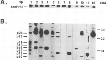 FIG. 8.markerswerep23,BIVBIVNCtermBIV-infectedand10),BIV(B) Western immunoblot analysis of recombinant and native Gag proteins
