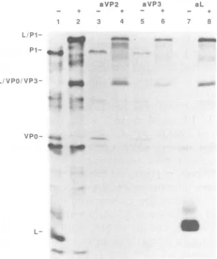 FIG. 3.vineproductsFMDV-infectedlescent-phase,CytoplasmicFMDV-infected3,inextractsLF-BKinfected,respectively,FMDV-infectedLanes:tracts[35S]methionine extract vitro Immunoprecipitationofcytoplasmicextractsfrom LF-BK cells in the absence or presence of E-64