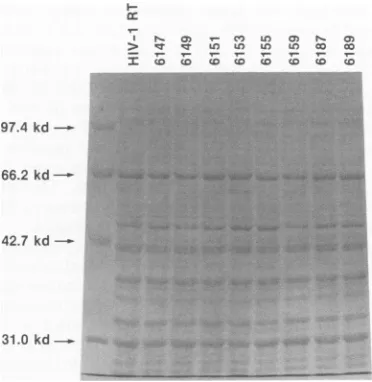 FIG. 1.werecoliBacteriapredictedofinRTCoomassieSDS-9.0%(e.g., 1x RT Level of expression of mutant HIV-1 RTs in E