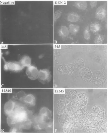 FIG. 3.viruswithfetalPhase-contrasttransfectedcellsserumanti-NS5 Subcellular localization of the unprocessed precursor NS345