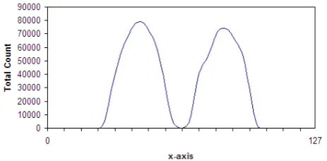 Fig. 1   Sample horizontal topographic representation of a subject SPECT  scan. The dividing point identified in this case is x=62
