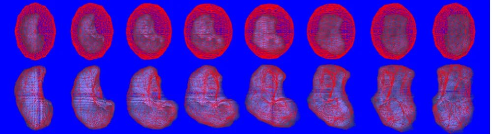 Fig. 6   Sample SPECT lung delineation of a left lung with the top row showing the initial starting ROI (φ=10 and θ=30) encasing the post dualexponential threshold lung, and the bottom row showing the final delineation after 3D active contours
